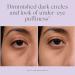 EXUVIANCE Bright Eyes Dark Circle Corrector 15g - Hydrating Eye Cream with Algae Extracts, Peptides, Polyhydroxy + Bionic Acids - Fragrance-Free - Buy Online on SooperMarket.com