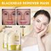 Peel Off Face Masks Retinol Gold Foil Peel Off Mask Gold Facial Mask Anti Wrinkle Anti Aging Face Mask Skincare Blackhead Remover Moisturizing Gold Mask Fade Fine Lines Brightening - Buy Online on SooperMarket.com