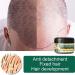 Endxedio Natural Ginger Serum Hair Growth Cream - Boost Moisturizing & Stimulate Hair Follicles for Unisex Hair Loss Treatment (2PCs) - Buy Online on SooperMarket.com
