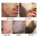 East Moon Beard Shaping Pen 2PC Set | Beard Growth Serum Oil & Roller | Best Gift for Men - Buy Online on SooperMarket.com