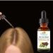 Moringa Oil - 100% Pure Cold-Pressed Vegan Hair & Skin Oil | Organic Non-GMO | All-Natural Anti-Wrinkle Treatment - Buy Online on SooperMarket.com