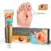 KXC Decubitus Treatment Cream 20g - Relief for Pressure Sores (4 pcs) - Buy Online on SooperMarket.com