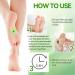 LUKMLCA Bee Venom Lymphatic Drainage Slimming Foot Patch LUKMLCA Bee Venom Foot Patch Bee Venom Lymphatic Drainage & Slimming Patches Effective Feet Health Patches for Foot and Body Care (1 Bag) - Buy Online on SooperMarket.com
