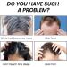 Nmbol Hair Growth Spray 1 - Buy Online on SooperMarket.com