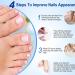 Fungal Nail Treatment - Nail Fungus Treatment for Toenail - Toe Nail Treatment Extra Strong - Nail Repair Treatment for Restores Damaged Nails - 8 Hours Nail Repair Restores Healthy Nails(32 Patches) - Buy Online on SooperMarket.com