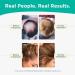 Vegan Hair Loss Shampoo and Conditioner Set | Dermatologist Developed DHT Fighting Treatment for Thinning Hair | Healthier, Fuller, Thicker Hair | 1-Month Supply - Buy Online on SooperMarket.com