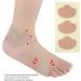 Corn Remover Pads - Self-Stick Adhesive Cushions for Foot Corn Removal (10 Pcs) - Buy Online on SooperMarket.com