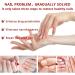 TBeautfave Fungal Nail Treatment Antifungal Nail Treatment Toe Nail Fungal Treatment Fungal Nail Treatment for Toenails Extra Strong Nail Repair and Strengthen Fix & Renew Damaged Broken Nails - Buy Online on SooperMarket.com