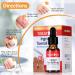 Ingrown Toenail Treatment - Ingrown Toenail Pain Reliever and Softener Kit for Easy Trimming with Silicone Gel Toe Caps Clear - Buy Online on SooperMarket.com