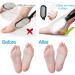 Sularpek Foot File Foot Scraper Best Foot Care Pedicure Metal Surface Tool to Remove Hard Skin Can Be Used on Both Wet and Dry Feet Surgical Grade Stainless Steel File - Buy Online on SooperMarket.com