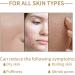 Rice Toner 150ML Smoothing Pore Minimizer & Moisturising Facial Toner - Niacinamide Essence for Dry Skin - Redness & Exfoliating - 1pc - Buy Online on SooperMarket.com