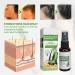 3Pcs x 30ml Strengthens Hair Spray Hair Tonic Dense Hair Repair - Deep Nourish Repair Reduces Frizzy - Buy Online on SooperMarket.com