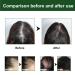 Troonz Rosemary Oil for Hair Growth | 60ml Natural Remedy for Hair Loss Nourishes Scalp & Damaged Hair - Buy Online on SooperMarket.com