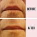 SiO Beauty Super LipLift | Anti-Wrinkle Patches 2 Week Supply - Buy Online on SooperMarket.com