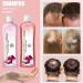Onion & Rosemary Shampoo for Hair Growth | Biotin Anti Hair Loss Shampoo 16.76 fl oz - Buy Online on SooperMarket.com