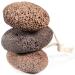 Foot Pumice Stone 3 Piece Portable Foot Stone Scrubber for Dead Skin - Buy Online on SooperMarket.com