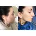Dark Spot Corrector & Brightening Serum with Kojic Acid, Vitamin C, Salicylic Acid & More | Melasma Treatment Cream by Admire My Skin - Buy Online on SooperMarket.com