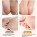Teksome Electric Foot File - Skin-Friendly Foot Callus Remover Rechargeable Feet Scrubber Automatic Powerful Heel Scraper for Cracked Heels Feet Hard Cracked Dry - Buy Online on SooperMarket.com