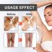 Snow Bleach Cream: Lighten Intimate Areas & Brighten Skin - 2pc Intensive Face & Body Treatment - Buy Online on SooperMarket.com