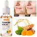 Turmeric Serum for Dark Spots Removal Turmeric Dark Spot Corrector Serum for Face & Body Turmeric Oil Age Spot Corrector Skin Care Moisturizing Serum - Buy Online on SooperMarket.com