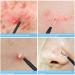 Fangze Pimple Popper Tool Kit - 10pcs Stainless Steel Blackhead Remover Set with Leather Bag - Buy Online on SooperMarket.com