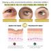 Retinol Eye Cream & 24k Under Eye Patches Kit - Anti-Aging Dark Circles & Puffy Eyes Treatment - Moisturizing & Firming Formula - Buy Online on SooperMarket.com