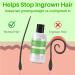 LAVO Tea Tree Gel with Salicylic Acid - Ultimate Ingrown Hair Treatment for Men and Women - Razor Bump and Burn Remover - Ideal for Bikini Lines, Acne, and Post-Hair Removal - Waxing, Shaving, Laser, Electrolysis - Buy Online on SooperMarket.com