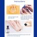 Fungal Nail Treatment For Toenails - Extra Strong Nail Fungus Treatment for Toenail - Toe Nail Fungal Treatment - Anti-Fungal Nail Repair Treatment with Nail File and Nail Brush - Buy Online on SooperMarket.com