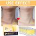 Collagen Neck Mask Dark Neck Remover Neck Wrinkle Patches Anti Aging Neck Mask 24K Gold Anti Wrinkle Patches For Skin Anti Ageing Neck Wrinkle Patch For Neck Tightening And tightening - Buy Online on SooperMarket.com