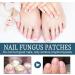 Fungal Nail Treatment - Extra Strong Nail Fungus Treatment for Toenail and Fingernail - Fungal Nail Eliminator Anti fungus Nail Repair and Strengthen Fix & Renew Damaged Broken Nails 30ml - Buy Online on SooperMarket.com