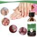 Nail Fungus Treatment For Toenail - Extra Strong Fungal Nail Treatment - Anti fungus Nail Repair and Strengthen Fix & Renew Damaged Broken Nails (2PC) - Buy Online on SooperMarket.com