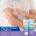 Tinea Versicolor Natural Skin Cream - Effective Treatment for All Skin Types - Buy Online on SooperMarket.com