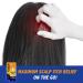 Scalpicin Max Strength Scalp Itch Treatment 1.5 oz - Effective Relief for Itchy Scalps | Buy Online Internationally - Buy Online on SooperMarket.com