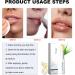 Lip Lightening For Dark Lips Aloe Vera Lip Balm Lips Pink Bleaching Cream Balm Moisturizing Lip Balm Whitening & Brightening Remove Dark Lips 3g - Buy Online on SooperMarket.com