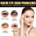 C lyn Instant Firmx Eye Tightener | Reduce Eye Bags & Puffiness | Anti-Aging Eye Cream for All Skin Types (2PCs) - Best International Shipping - Buy Online on SooperMarket.com