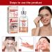 Speedy Milia Remover Milia Remover Milia Remover Under Eyes Milia Spot Serum for Face Helps Dissolve and Reduce Milia Dark Spot Remover to Reduce Milia Dark Circles Under Eye for Women & Men - Buy Online on SooperMarket.com