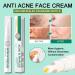 Anti-Acne Face Cream Spot Cream for Acne Treatment and Spot Treatment Skin Treatment Gel Cream For Face Blemishes & Blackheads Acne Treatment Cream Anti Acne Spot - Buy Online on SooperMarket.com