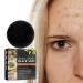 Nmbol Skin Acne Soap Soap for Removal of Black Spots ening Soap for Dark Skin Natural Soap Face Body Fixed Facial Cleaning Vegan For All Skin Types