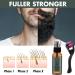 Yajexun Beard Grooming Kit - 30ml Beard Care Set for Men | Beard Growth Kit with Bart Roller & Growth Serum Oil - Buy Online on SooperMarket.com