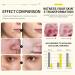 Skincare Set for Acne Prone Skin Anti Acne Skin Care Sets & Kits Skincare Gift Set with Cleanser- Serum- Essence Gel- Mask*2 Acne Remove Oil Control Facial Kit Hydrate Shrink Pore Sooth Redness - Buy Online on SooperMarket.com
