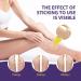 Varicose Vein & Spider Vein Cream | Capillary Health Treatment | Improve Circulation 0.7oz - Buy Online on SooperMarket.com