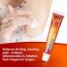 Itching Cream for Minor Irritations | Soothes and Restores Irritated Skin | Health Care for Men and Women - Buy Online on SooperMarket.com