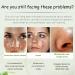 Acne Cream Moisturiser Face Cream Spot Cream Mens Moisturiser Tea Tree Cream Spot Cream For Acne Cream Moisturiser for Women Men Teenagers Dilute Face Prone Spot Marks Balance Facial Oil Cream - Buy Online on SooperMarket.com