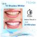 MySmile Teeth Whitening Kit | 14 Sets Strips & 3 Gel Lights | Fast Whitening, Reduced Sensitivity | Remove Stains from Coffee, Wine & Smoking - Buy Online on SooperMarket.com