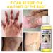 Yellow Peeling Oil for Dark Skin - Strong Extra Strength Exfoliating Solution with Salicylic Sodium Hyaluronate - 110ML/3.66 OZ - Buy Online on SooperMarket.com