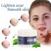 Scar Gel - Skin Repair and Removal Treatment for Face, Body, Surgery, Burns, Stretch Marks - Buy Online on SooperMarket.com