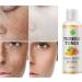 Turmeric Dark Spot Corrector Toner 4oz - Facial Toner for Acne Prone Skin - Hydrating Dark Spot Remover for Women - Hyperpigmentation Treatment for Dry Oily Skin - Buy Online on SooperMarket.com