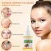 Turmeric & Vitamin C Dark Spot Corrector Serum | Anti-Aging & Moisturizing Formula for All Skin Types - 1oz - Buy Online on SooperMarket.com