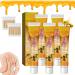 RJDJ Bee Venom Psoriasis Treatment Cream New Zealand Bee Venom Professional Psoriasis Treatment Cream Psoriasis Treatment for All Skin Types (5PC)