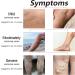 Marronie Oil for Varicose Veins Marronie Chamomile Essential Oil for Varicose Veins 1/3/5 Pack Marronie Oil Varicose Veins (3pcs) - Buy Online on SooperMarket.com